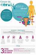 Image result for Endometrial Cancer vs Cervical Cancer