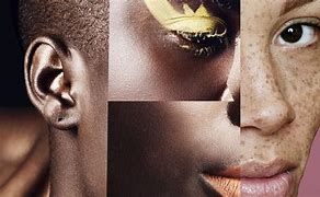 Image result for Skin Color Conditions