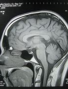 Image result for Human Brain Shrinking