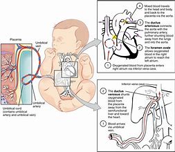 Image result for Umbilical Cord Cell Storage