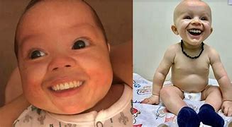 Image result for Funny Babies with Teeth