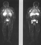 Image result for Labelled White Cell Scan