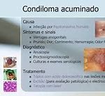 Image result for acuminadp
