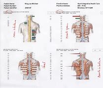 Image result for Chiropractor Evgeni Trigubov