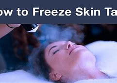 Image result for Freeze Off Skin Tags