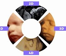 Image result for Ultrasound Graphics