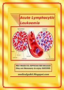 Image result for Acute Lymphoblastic Leukemia Pathophysiology