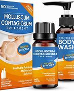 Image result for Molluscum Contagiosum Treatments for Adults