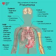 Image result for Pneumonia Signs and Symptoms