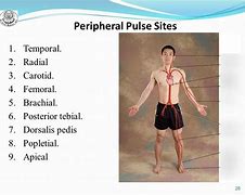 Image result for Carotid and Peripheral Pulse