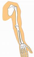 Image result for Bone Spur On Elbow Tip