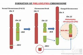 Image result for chromosom_philadelphia