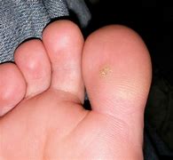 Image result for Warts On Dogs