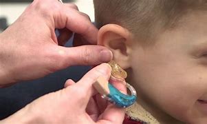 Image result for Kids with Hearing Aids