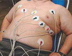 Image result for LGL On EKG