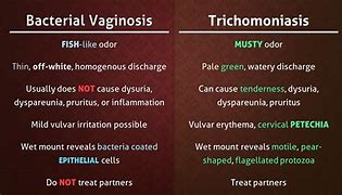 Image result for Discharge From Trichomoniasis