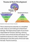 Image result for Trauma and Memory