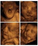 Image result for 29 Week Baby