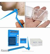 Image result for Wart Remover Tool