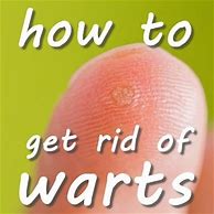 Image result for How to Get Rid of Warts Disease