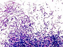 Image result for Gram-positive Bacteria