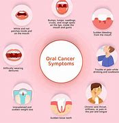 Image result for Diagnosis of Jaw Cancer
