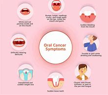Image result for Sure Signs of Oral Cancer