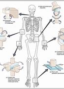 Image result for Hidge Joints