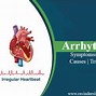 Image result for angina