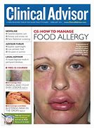 Image result for Fish Allergy Notice Sign