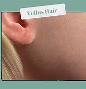 Image result for Vellus Hair Child