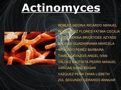 Image result for actimomices