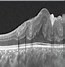 Image result for Oct Retina