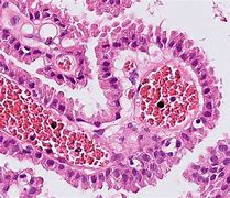 Image result for Choroid Plexus Cells