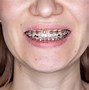 Image result for dentar