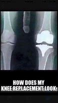 Image result for Funny X-ray of Brain in Knee