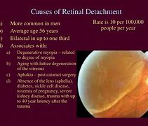 Image result for Retina Photopsias