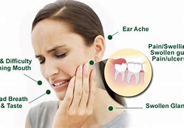 Image result for Wisdom Teeth Pain