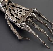 Image result for Arm Prosthesis