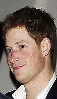 Image result for Prince Harry Nose