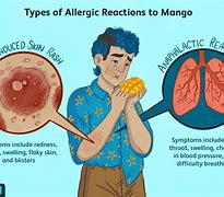 Image result for Apple and Pit Fruit Allergy