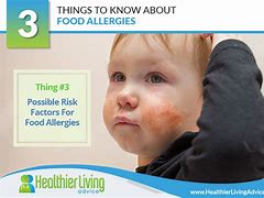 Image result for Top 9 Food Allergens