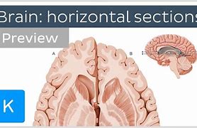 Image result for Horizontal View of Human Brain