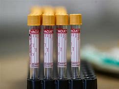Image result for Covid Test-Tube