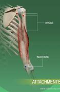 Image result for Muscle Tear Location