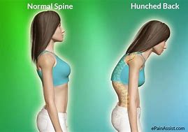 Image result for Posture Brace Lower Back