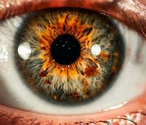 Image result for Hazy Vision in One Eye