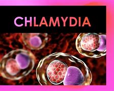 Image result for Chlamydia in Urine