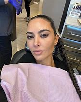 Image result for Kim Kardashian Acne