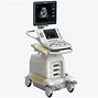 Image result for Automated Ultrasound